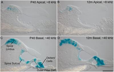 Accelerated Age-Related Degradation of the Tectorial Membrane in the Ceacam16βgal/βgal Null Mutant Mouse, a Model for Late-Onset Human Hereditary Deafness DFNB113